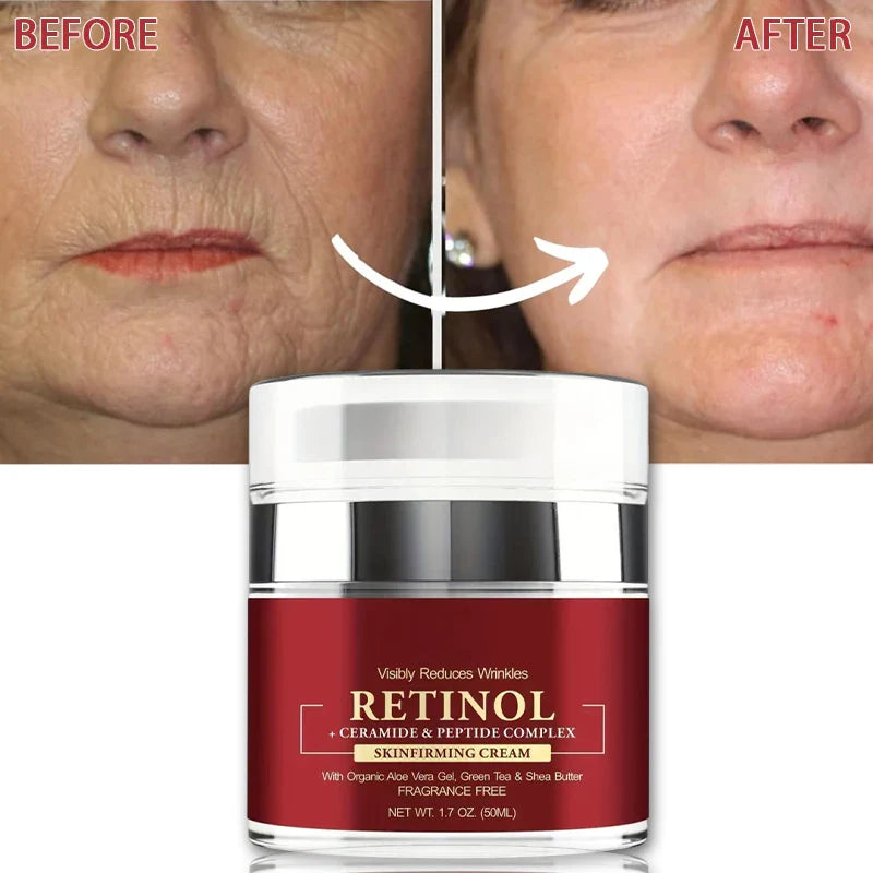 Instant Retinol Cream for Firming & Lifting Skin-0
